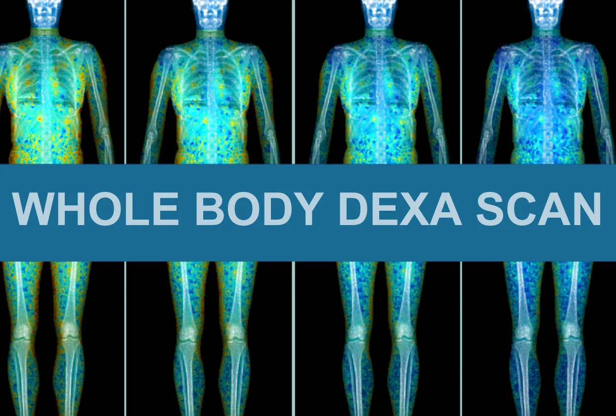 dexa scan