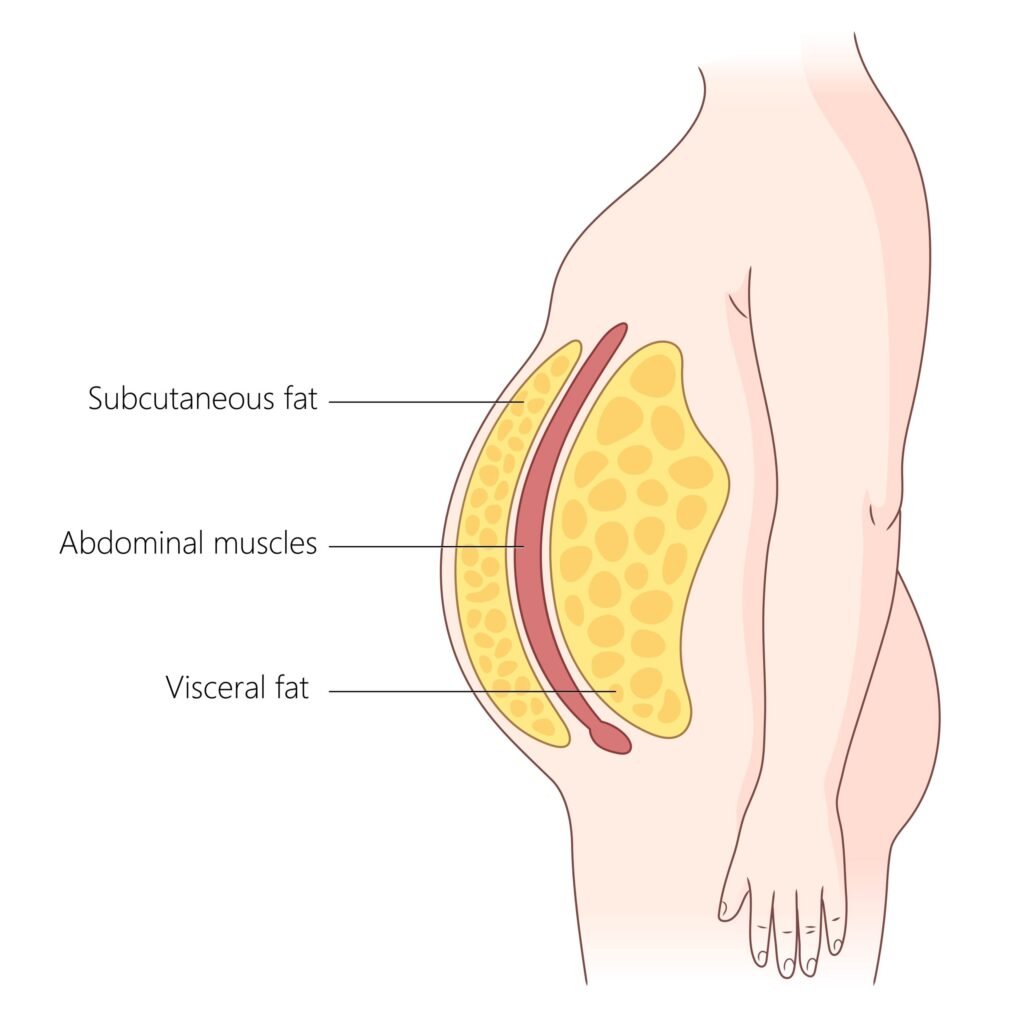 visceral fat subcutaneous fat scaled 1 visceral fat subcutaneous fat scaled 1